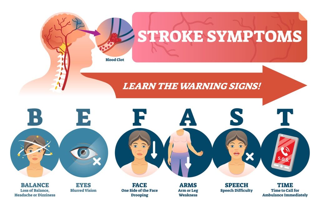 stroke-symptoms-and-prevention